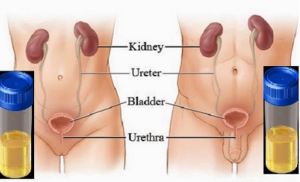 पिसाब पोल्ने समस्याको घरेलु उपचार